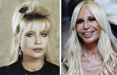 donatella versace uomo|donatella versace before and after.